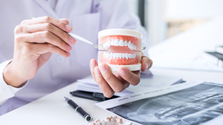 お口の状態のご説明