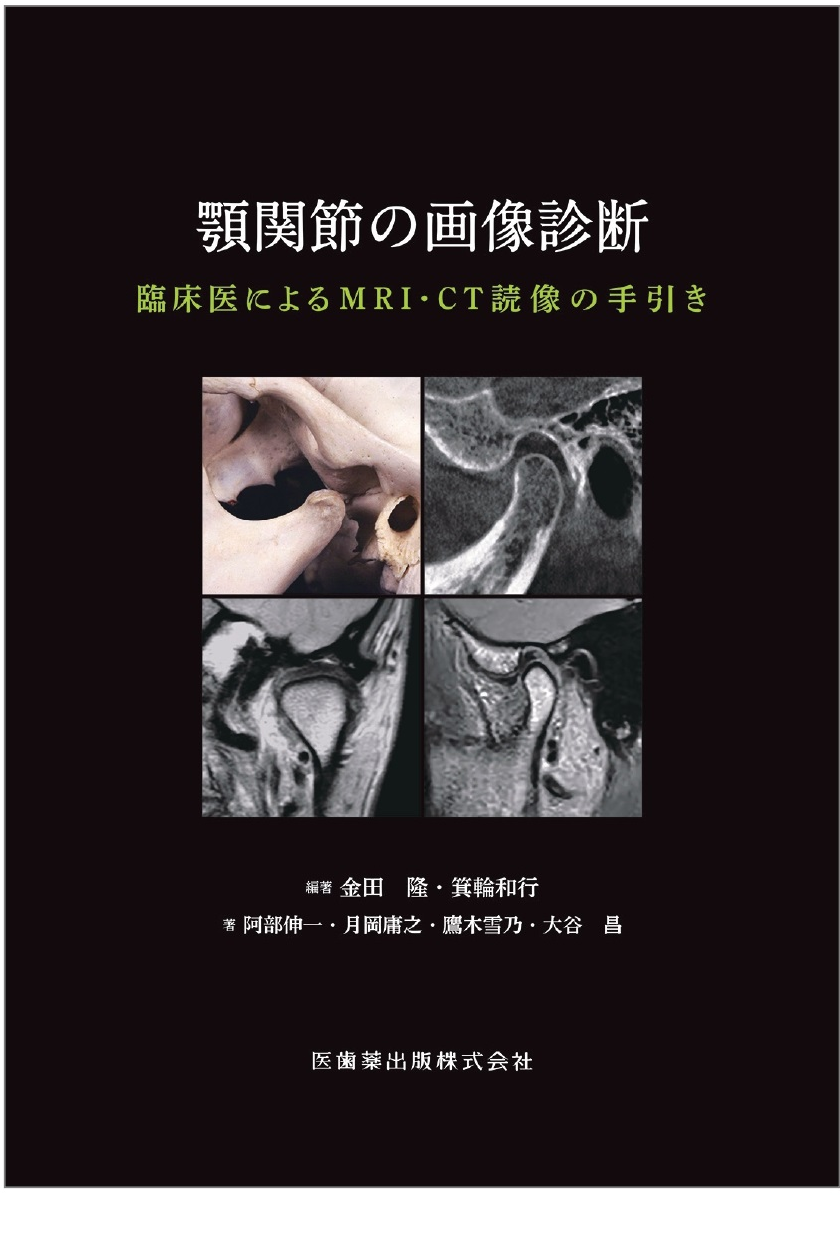 顎関節の画像診断 書影